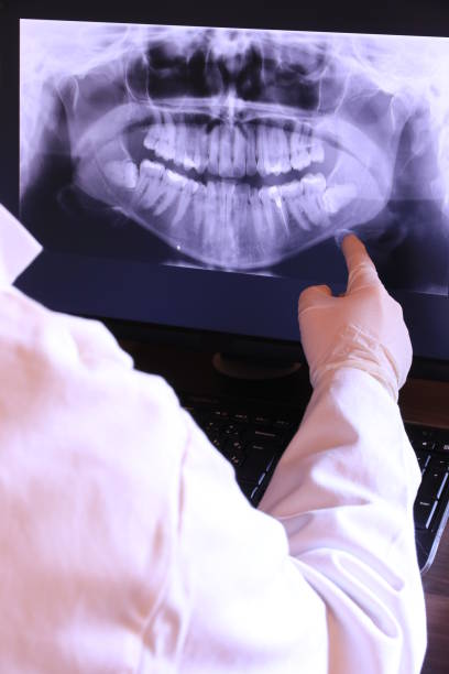 Best Emergency Treatment for Oral Infections in Aurora, CO
